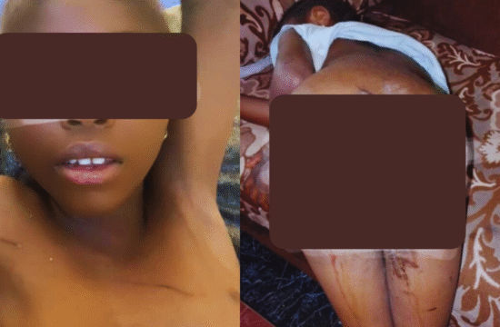 Bauchi Woman Burns 7-Year-Old Niece’s Private Part With Hot Knife, Accuses Her of WitchcraftBauchi Woman Burns 7-Year-Old Niece’s Private Part With Hot Knife, Accuses Her of Witchcraft