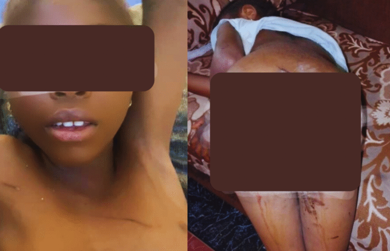 Bauchi Woman Burns 7-Year-Old Niece’s Private Part With Hot Knife, Accuses Her of WitchcraftBauchi Woman Burns 7-Year-Old Niece’s Private Part With Hot Knife, Accuses Her of Witchcraft