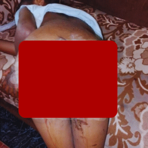 Bauchi Woman Burns 7-Year-Old Niece’s Private Part With Hot Knife, Accuses Her of Witchcraft