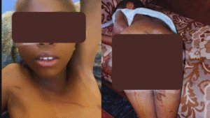 Bauchi Woman Burns 7-Year-Old